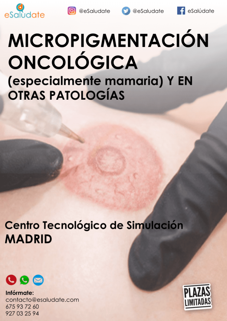 Micropigmentación Oncológica
