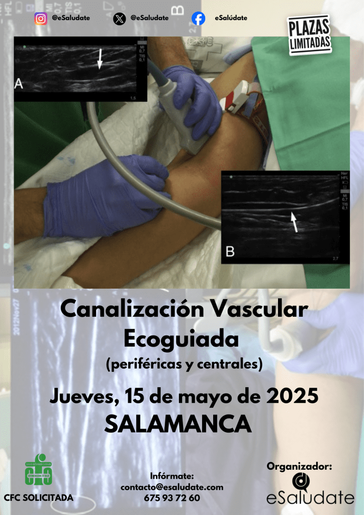 Canalización Vascular Salamanca