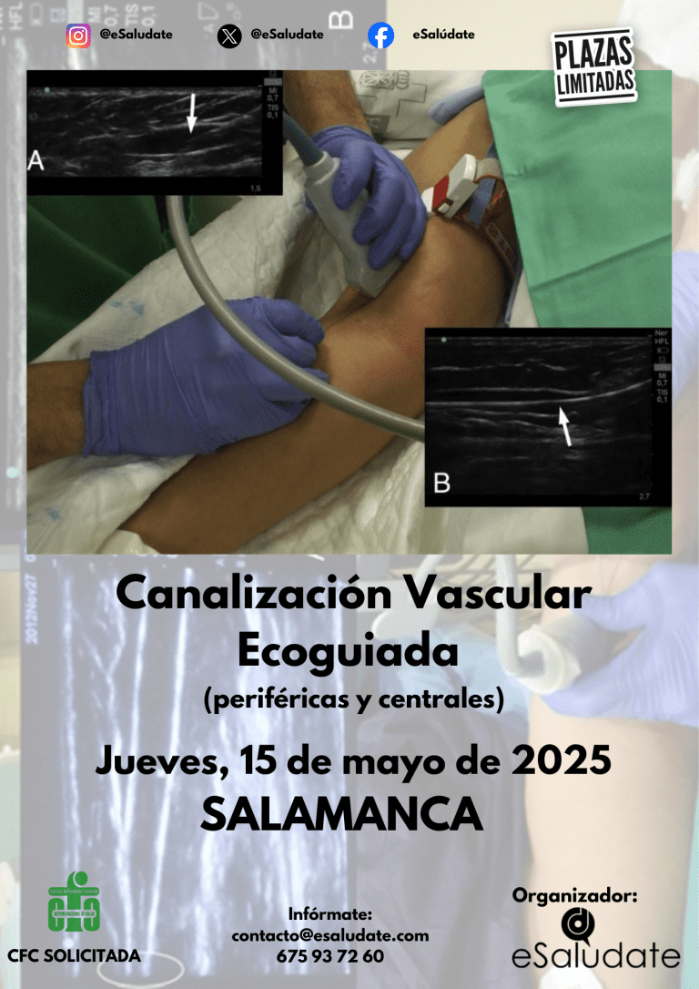 Canalización Vascular Salamanca