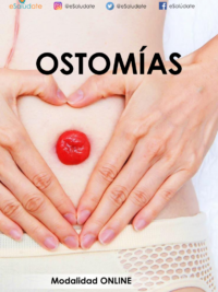 Curso online ostomías